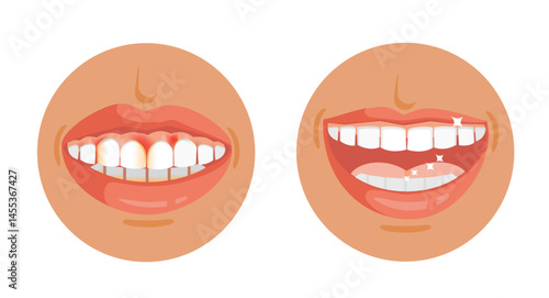 Good and bad dental health