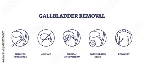 Gallbladder removal is shown with outline icons of surgery, absence, intervention, post-surgery, and recovery. Outline icons set