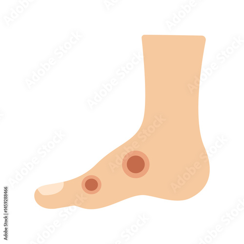 anthrax infection disease concept