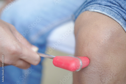 Doctor neurologist knocking on knee of patient with hammer in clinic closeup. Diagnosis of neurological pathology of knee reflex concept