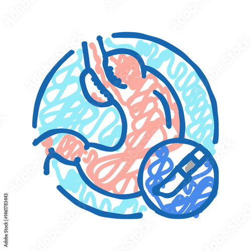 fundoplication surgery icon doodle illustration