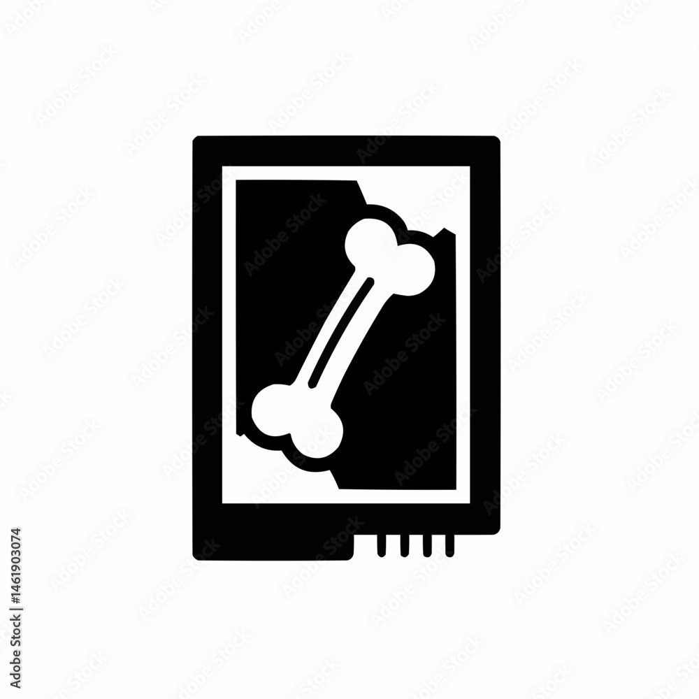 A fractured bone is displayed in an X-ray film frame for medical diagnosis A fractured bone is displayed in an X-ray film frame for medical diagnosis
