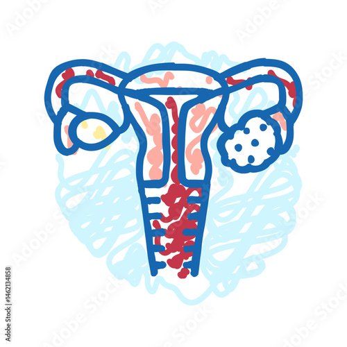 polycystic ovary syndrome woman disease icon doodle illustration