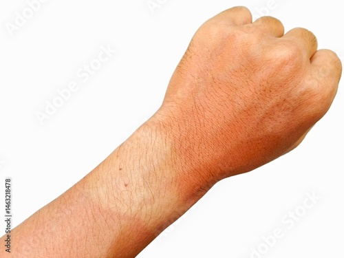 Wallpaper Mural Arm Showing Sun Tan Line After Outdoor Activity on White Torontodigital.ca