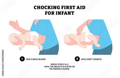 Baby chest rescue breath care safety for Choking first aid food CPR child, educational medical poster design healthcare, labeled give 5 back blows chest thrusts, swallow back Heimlich maneuver blows.