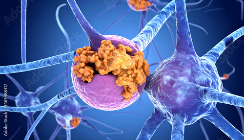 Understanding Amyloid Plaques: Microscopic View of Alzheimer's Disease