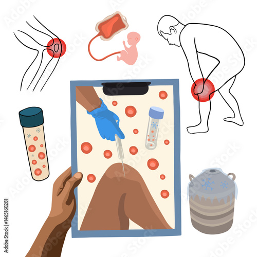 Vector isolated illustration of stem cell treatment. Stem cells in a test tube. Stem cells are injected into the knee.