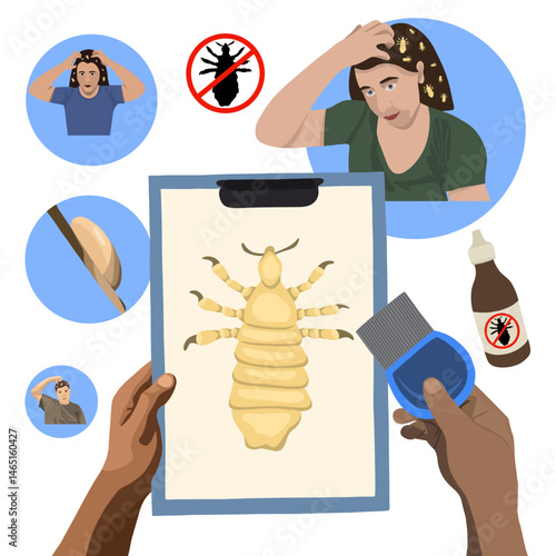 Vector isolated illustration of pediculosis disease set. People with pediculosis. Combing nits. A remedy for pediculosis.