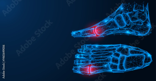 Gout, damage to the joints of the foot. Polygonal design of lines and dots. Blue background.