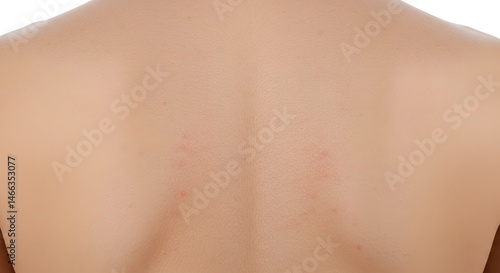 Wallpaper Mural Back with Skin Rash Torontodigital.ca