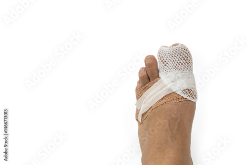 Wounded toe with bandage on white background