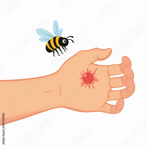 Cartoon hand showing a painful bee sting, vector illustration