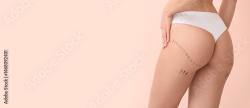 Young woman with marks on h...