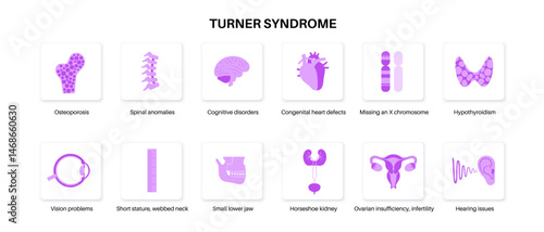 Turner syndrome poster