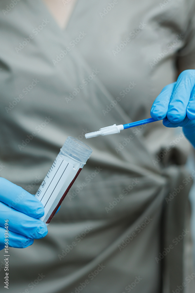 Smear for virus detection. Taking analysis with a smear. Nurse's hands close-up with a smear.
