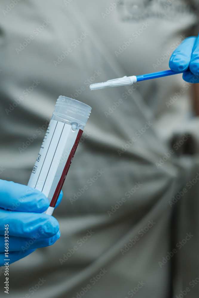 Smear for virus detection. Taking analysis with a smear. Nurse's hands close-up with a smear.