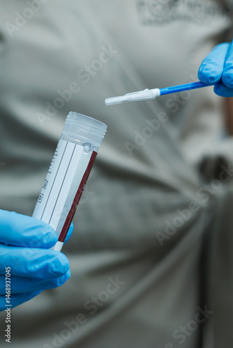 Obraz na płótnie Smear for virus detection. Taking analysis with a smear. Nurse's hands close-up with a smear. w salonie