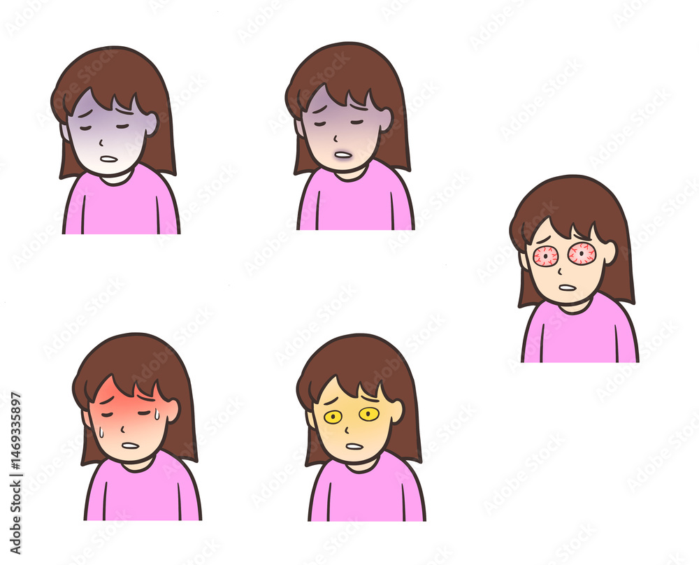蒼白、黄疸、発熱などで顔に症状が出ている女性のイラスト 蒼白、黄疸、発熱などで顔に症状が出ている女性のイラスト