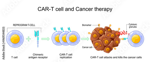 CAR T-cell therapy. Process of Cancer immunotherapy.