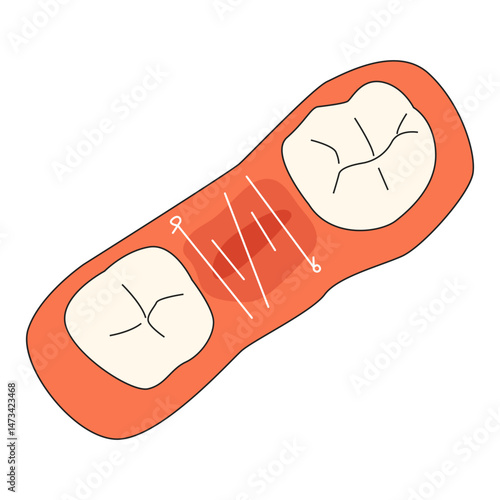 dental suturing