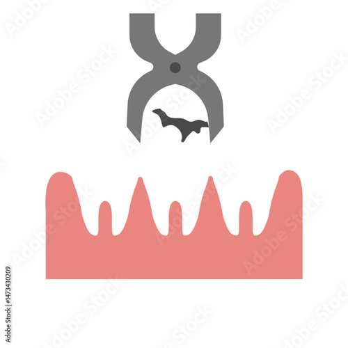 teeth extraction
