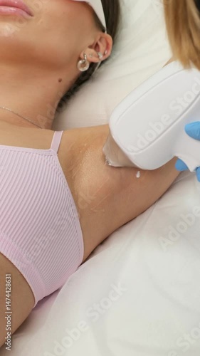 Close-up of caucasian woman armpit aria during procedure of laser hair removal in a beauty salon. Body hair removal, epilation