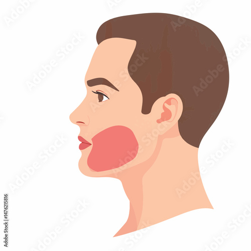 Profile view of male face with swollen jaw, health awareness