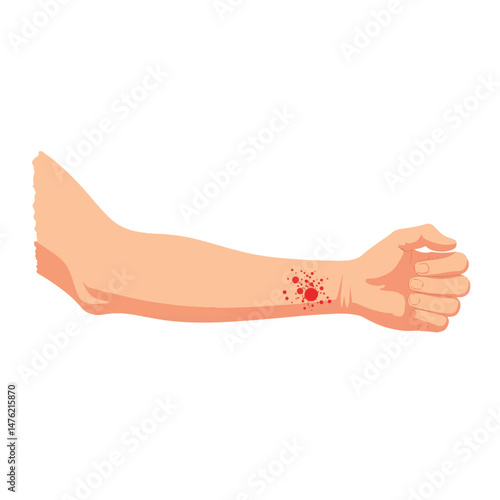 Close-up of forearm with itchy rash on white background, medical illustration