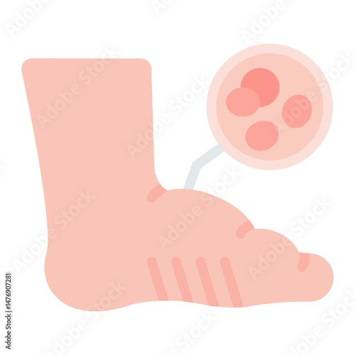 Swelling icon vector image. Can be used for Skin Burns.