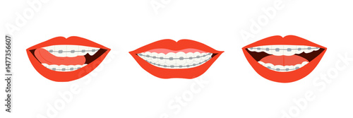 A vector collection of red lips smiling with visible dental braces. Includes three unique smiles showcasing orthodontic braces. Perfect for dental clinic promotions