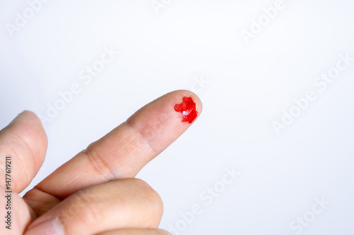 Obraz na plátně A light-skinned finger has a small puncture wound on its tip, from which a single, bright red drop of blood has emerged