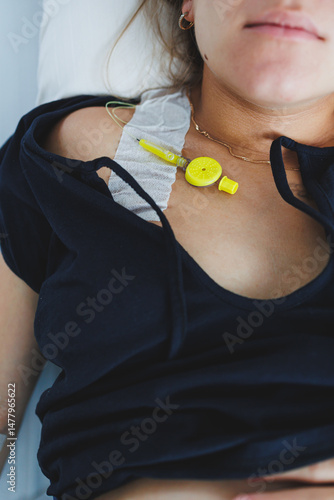 Obraz na płótnie The patient is currently equipped with an IV catheter and is being closely monitored in a hospital setting, where professional healthcare providers ensure optimal treatment and care during recovery w salonie