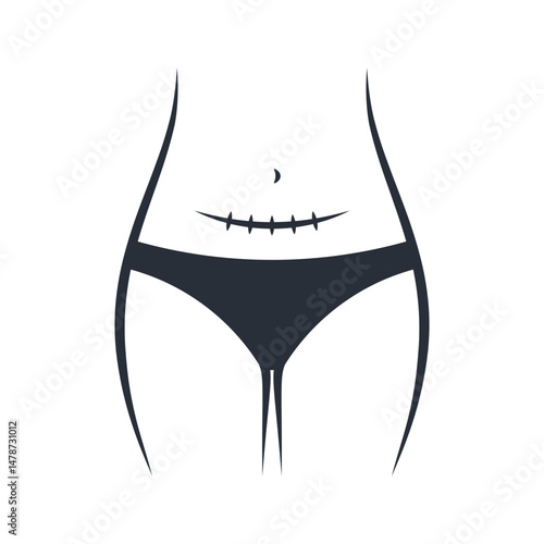 Belly caesarean scar line art vector isolated on white background