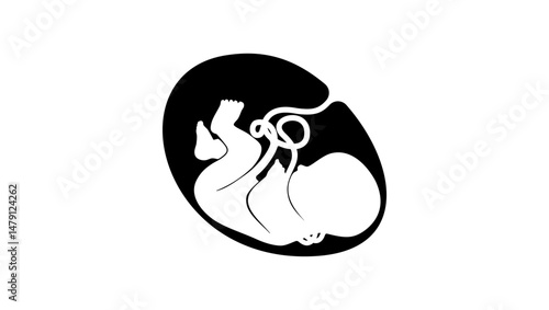 Umbilical Cord Is Wrapped Around The Fetal Neck, black isolated silhouette