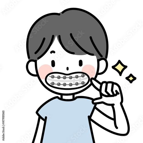 歯列矯正でワイヤーをする子供のイラスト