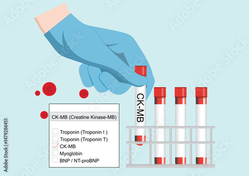 CK MB levels can help identify a reinfarction shortly after the first heart attack.