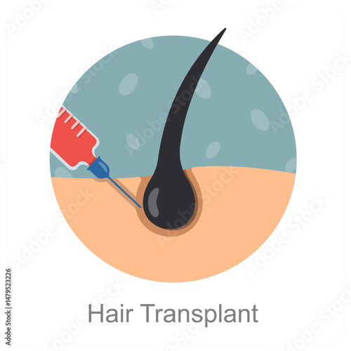 Hair Transplant
