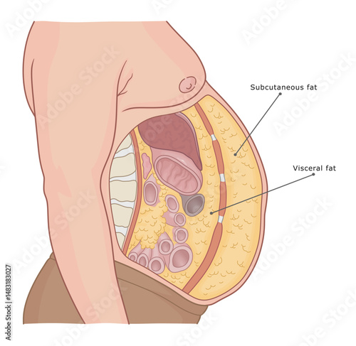 Visceral and subcutaneous fat labeled medical diagram. Vector illustration.