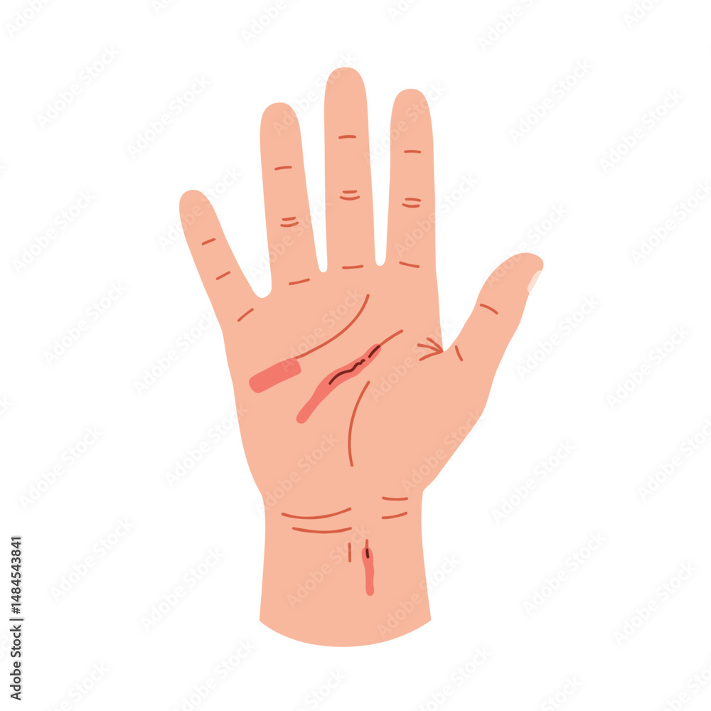 Hand with deep laceration and detailed injuries on skin  