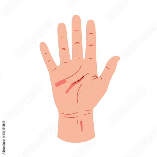 Hand with deep laceration and detailed injuries on skin  