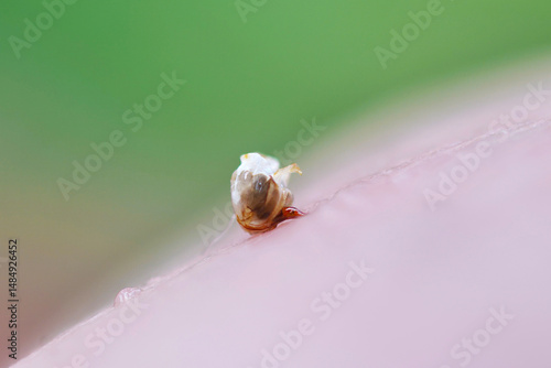 The bee left a sting with a vial of poison in the mans skin. The bubble contracts and delivers poison through the sting int
