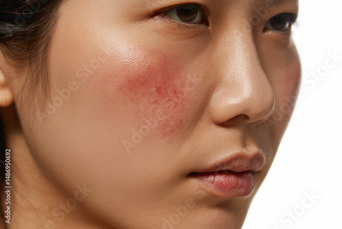 肌のトラブル 日本人女性 クローズアップ（スキンケア シミ 二キビ 赤み たるみ ゆるみ ）