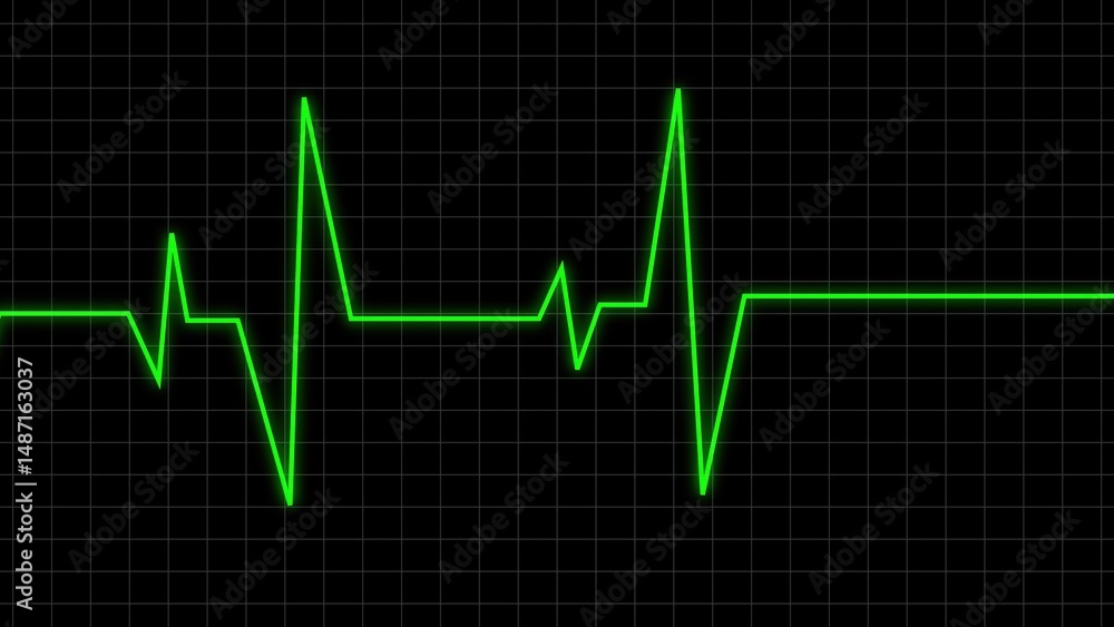 Naklejka premium A green heartbeat monitor line showing a flatline after a period of cardiac activity signaling the end of life or death