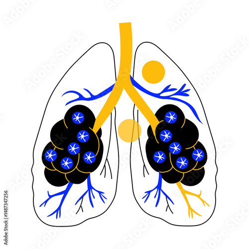 A doodle style illustration showing alveoli 
