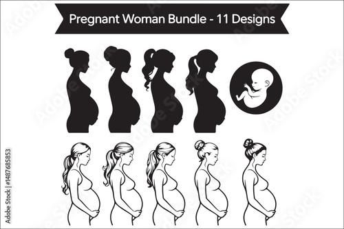 Pregnancy Silhouette Wall Art – Stages of Pregnancy Trimester Illustration – Maternity Gift for Mom-to-Be

