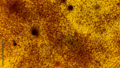 Microscopic view of microorganisms on a gold-toned background.  Dense, microscopic organisms in a golden field
