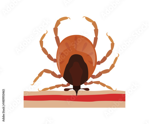 Encephalitis tick biting human skin, causing lyme disease and capillary vessel damage