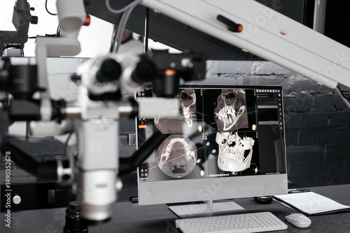 Microscope in dentistry on the background of the screen with images of the jaw. Concept of modern dental technology.