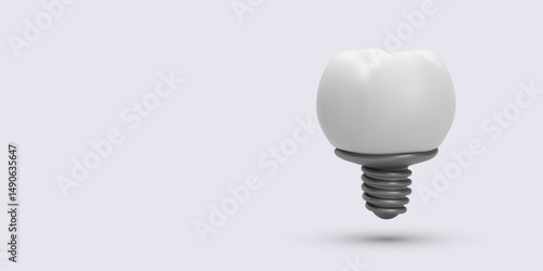 Dental Implant in Clean 3D Style Showing Tooth Crown with Metal Screw Base for Oral Surgery, Medical, or Dental Clinic Use. Vector Illustration