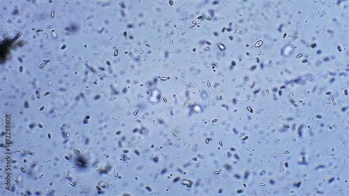 Micro organism Ciliates - microscope magnification
